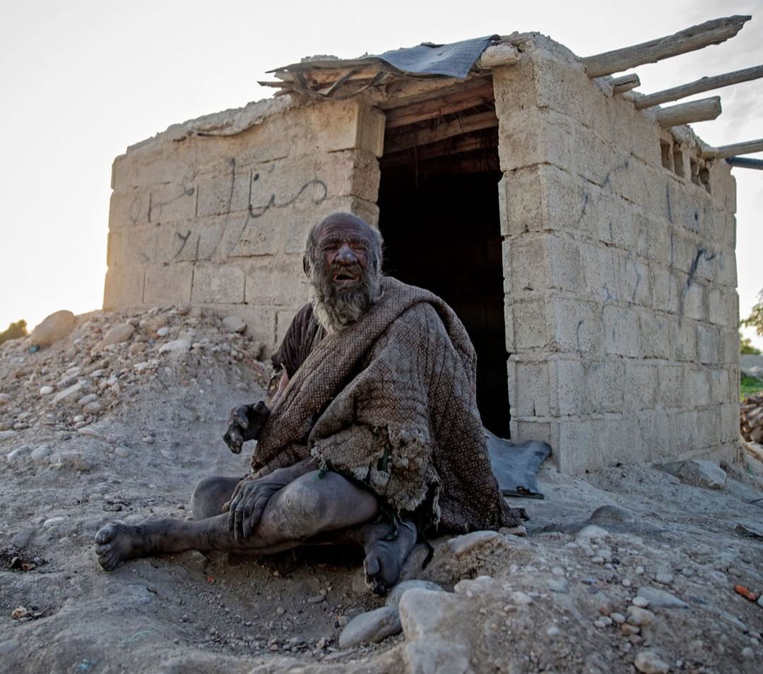 World Dirtiest Man Dies